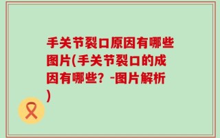 手关节裂口原因有哪些图片(手关节裂口的成因有哪些？-图片解析)