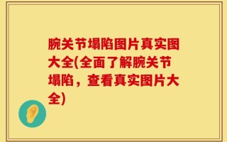 腕关节塌陷图片真实图大全(全面了解腕关节塌陷，查看真实图片大全)