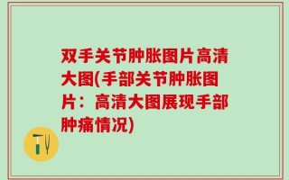 双手关节肿胀图片高清大图(手部关节肿胀图片：高清大图展现手部肿痛情况)