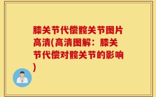 膝关节代偿髋关节图片高清(高清图解：膝关节代偿对髋关节的影响)