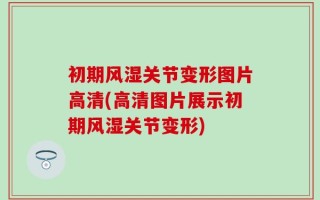 初期风湿关节变形图片高清(高清图片展示初期风湿关节变形)