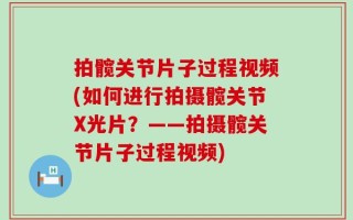 拍髋关节片子过程视频(如何进行拍摄髋关节X光片？——拍摄髋关节片子过程视频)