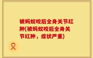被蚂蚁咬后全身关节红肿(被蚂蚁咬后全身关节红肿，症状严重)