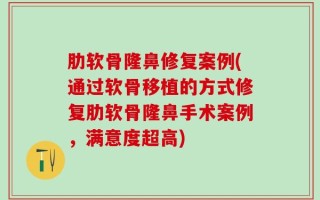 肋软骨隆鼻修复案例(通过软骨移植的方式修复肋软骨隆鼻手术案例，满意度超高)