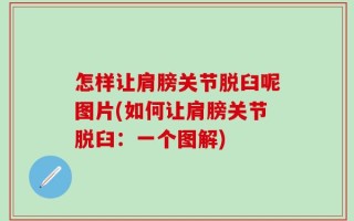 怎样让肩膀关节脱臼呢图片(如何让肩膀关节脱臼：一个图解)