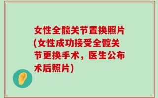 女性全髋关节置换照片(女性成功接受全髋关节更换手术，医生公布术后照片)