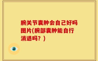 腕关节囊肿会自己好吗图片(腕部囊肿能自行消退吗？)