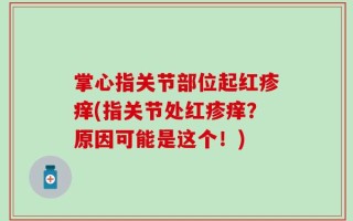 掌心指关节部位起红疹痒(指关节处红疹痒？原因可能是这个！)