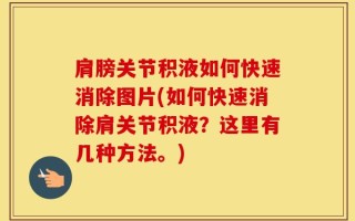 肩膀关节积液如何快速消除图片(如何快速消除肩关节积液？这里有几种方法。)