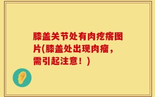 膝盖关节处有肉疙瘩图片(膝盖处出现肉瘤，需引起注意！)