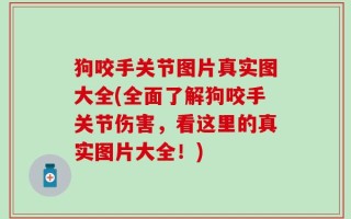 狗咬手关节图片真实图大全(全面了解狗咬手关节伤害，看这里的真实图片大全！)