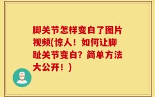 脚关节怎样变白了图片视频(惊人！如何让脚趾关节变白？简单方法大公开！)