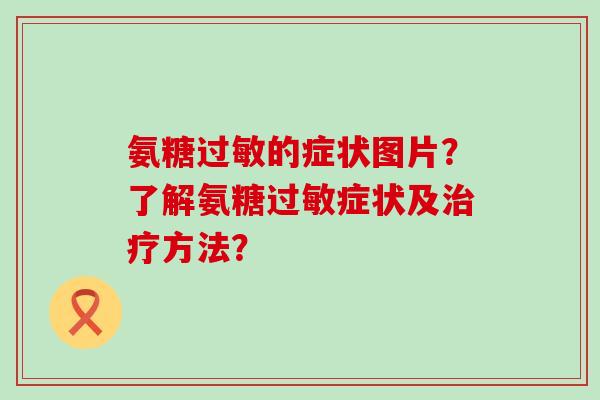 氨糖过敏的症状图片?了解氨糖过敏症状及治疗方法?-第1张图片-氨糖科普网 氨糖过敏的症状图片?了解氨糖过敏症状及治疗方法?-第1张图片-氨糖科普网