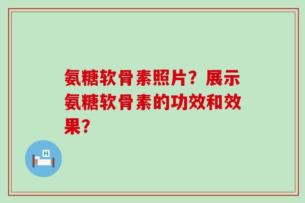 氨糖软骨素照片?展示氨糖软骨素的功效和效果?-第1张图片-氨糖科普网 氨糖软骨素照片?展示氨糖软骨素的功效和效果?-第1张图片-氨糖科普网