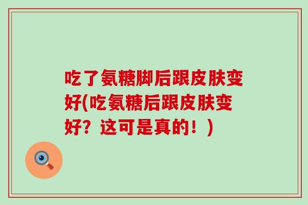 吃了氨糖脚后跟皮肤变好(吃氨糖后跟皮肤变好?这可是真的!)-第1张图片-氨糖科普网 吃了氨糖脚后跟皮肤变好(吃氨糖后跟皮肤变好?这可是真的!)-第1张图片-氨糖科普网