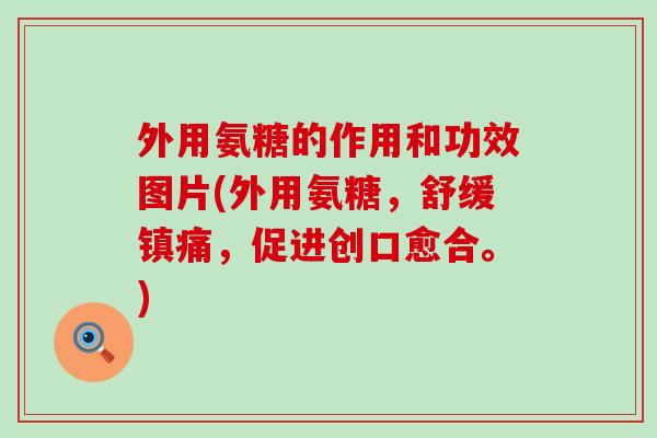 外用氨糖的作用和功效图片(外用氨糖,舒缓镇痛,促进创口愈合。)-第1张图片-氨糖科普网 外用氨糖的作用和功效图片(外用氨糖,舒缓镇痛,促进创口愈合。)-第1张图片-氨糖科普网