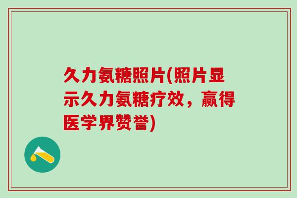 久力氨糖照片(照片显示久力氨糖疗效,赢得医学界赞誉)-第1张图片-氨糖科普网 久力氨糖照片(照片显示久力氨糖疗效,赢得医学界赞誉)-第1张图片-氨糖科普网