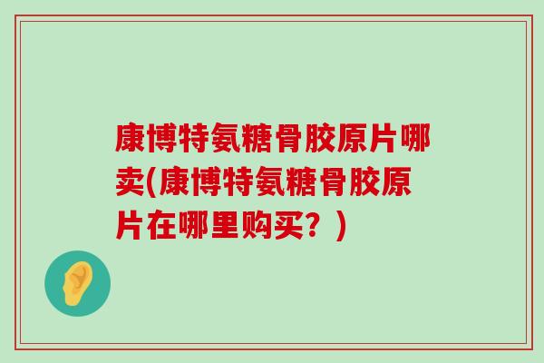康博特氨糖骨胶原片哪卖(康博特氨糖骨胶原片在哪里购买?)-第1张图片-氨糖科普网 康博特氨糖骨胶原片哪卖(康博特氨糖骨胶原片在哪里购买?)-第1张图片-氨糖科普网