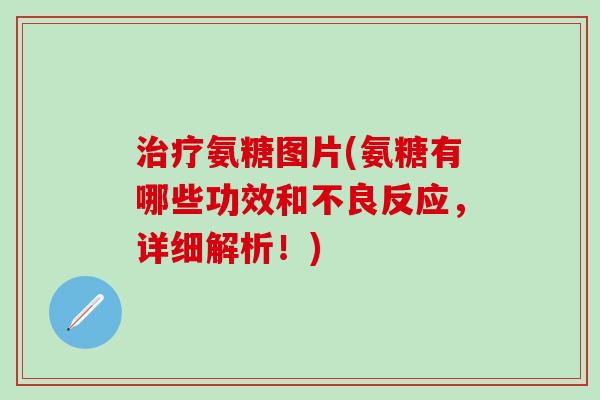 治疗氨糖图片(氨糖有哪些功效和不良反应,详细解析!)-第1张图片-氨糖科普网 治疗氨糖图片(氨糖有哪些功效和不良反应,详细解析!)-第1张图片-氨糖科普网