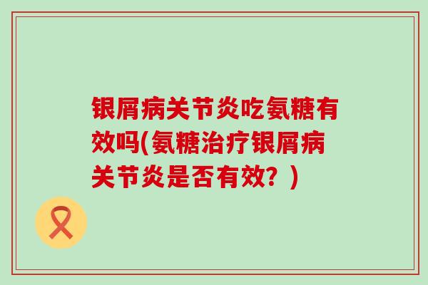 银屑病关节炎吃氨糖有效吗(氨糖治疗银屑病关节炎是否有效?)-第1张图片-氨糖科普网 银屑病关节炎吃氨糖有效吗(氨糖治疗银屑病关节炎是否有效?)-第1张图片-氨糖科普网