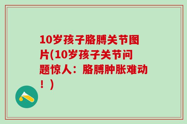 10岁孩子胳膊关节图片(10岁孩子关节问题惊人:胳膊肿胀难动!)-第1张图片-氨糖科普网 10岁孩子胳膊关节图片(10岁孩子关节问题惊人:胳膊肿胀难动!)-第1张图片-氨糖科普网