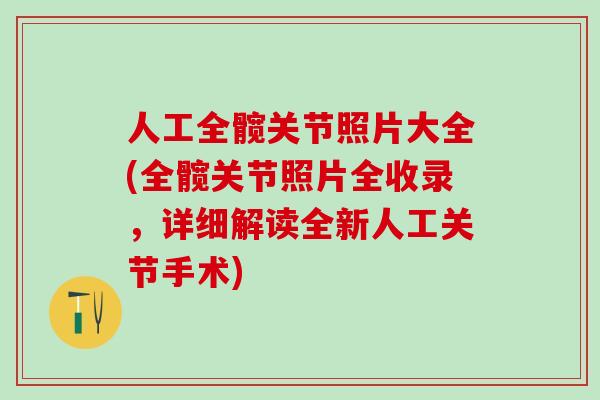 人工全髋关节照片大全(全髋关节照片全收录,详细解读全新人工关节手术)-第1张图片-氨糖科普网 人工全髋关节照片大全(全髋关节照片全收录,详细解读全新人工关节手术)-第1张图片-氨糖科普网