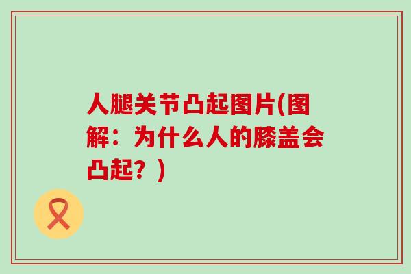 人腿关节凸起图片(图解：为什么人的膝盖会凸起？)-第1张图片-氨糖科普网