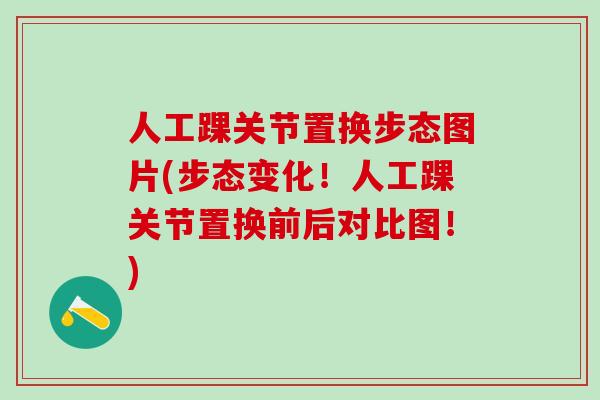 人工踝关节置换步态图片(步态变化!人工踝关节置换前后对比图!)-第1张图片-氨糖科普网 人工踝关节置换步态图片(步态变化!人工踝关节置换前后对比图!)-第1张图片-氨糖科普网