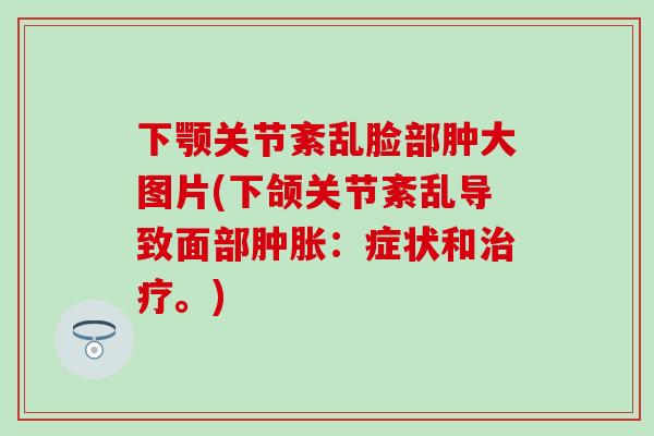 下颚关节紊乱脸部肿大图片(下颌关节紊乱导致面部肿胀:症状和治疗。)-第1张图片-氨糖科普网 下颚关节紊乱脸部肿大图片(下颌关节紊乱导致面部肿胀:症状和治疗。)-第1张图片-氨糖科普网