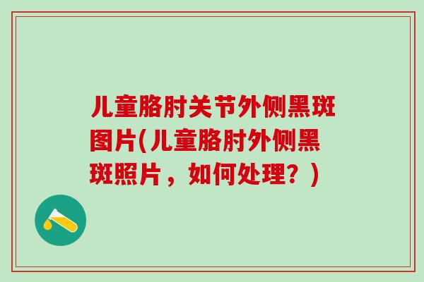 儿童胳肘关节外侧黑斑图片(儿童胳肘外侧黑斑照片,如何处理?)-第1张图片-氨糖科普网 儿童胳肘关节外侧黑斑图片(儿童胳肘外侧黑斑照片,如何处理?)-第1张图片-氨糖科普网