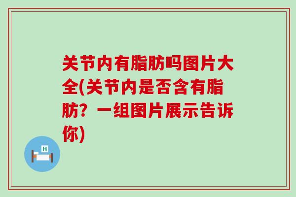 关节内有脂肪吗图片大全(关节内是否含有脂肪?一组图片展示告诉你)-第1张图片-氨糖科普网 关节内有脂肪吗图片大全(关节内是否含有脂肪?一组图片展示告诉你)-第1张图片-氨糖科普网