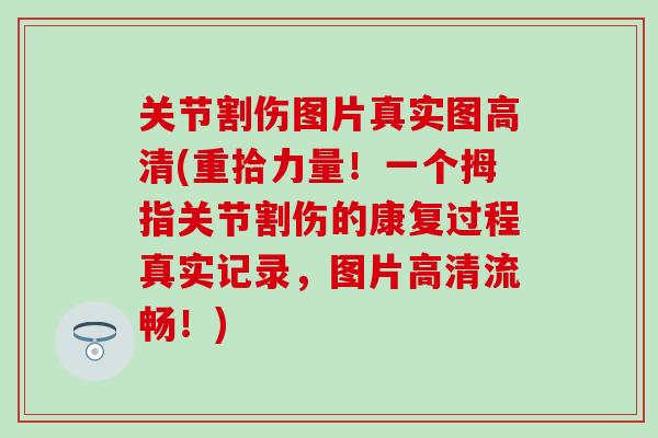 关节割伤图片真实图高清(重拾力量!一个拇指关节割伤的康复过程真实记录,图片高清流畅!)-第1张图片-氨糖科普网 关节割伤图片真实图高清(重拾力量!一个拇指关节割伤的康复过程真实记录,图片高清流畅!)-第1张图片-氨糖科普网