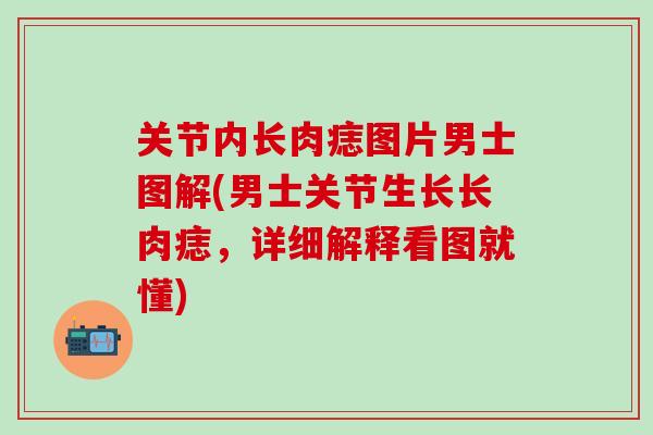关节内长肉痣图片男士图解(男士关节生长长肉痣,详细解释看图就懂)-第1张图片-氨糖科普网 关节内长肉痣图片男士图解(男士关节生长长肉痣,详细解释看图就懂)-第1张图片-氨糖科普网