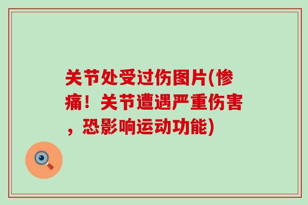 关节处受过伤图片(惨痛！关节遭遇严重伤害，恐影响运动功能)-第1张图片-氨糖科普网