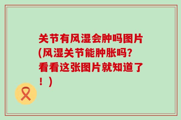 关节有风湿会肿吗图片(风湿关节能肿胀吗？看看这张图片就知道了！)-第1张图片-氨糖科普网
