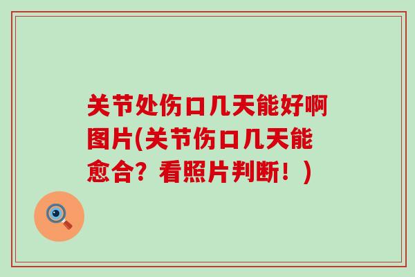 关节处伤口几天能好啊图片(关节伤口几天能愈合？看照片判断！)-第1张图片-氨糖科普网