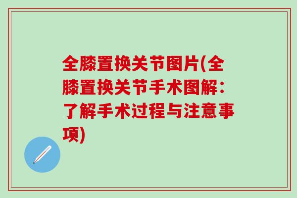 全膝置换关节图片(全膝置换关节手术图解：了解手术过程与注意事项)-第1张图片-氨糖科普网