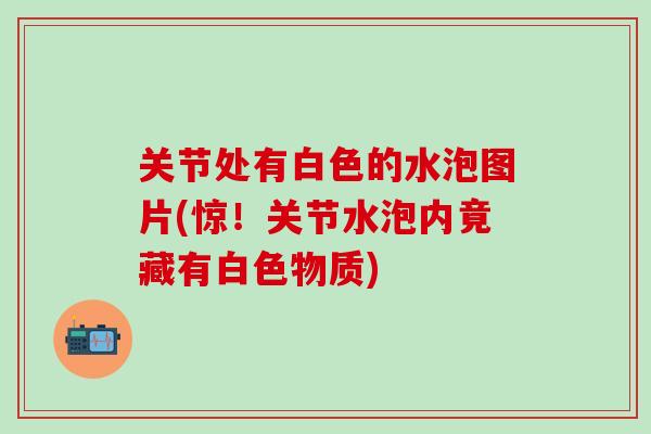 关节处有白色的水泡图片(惊!关节水泡内竟藏有白色物质)-第1张图片-氨糖科普网 关节处有白色的水泡图片(惊!关节水泡内竟藏有白色物质)-第1张图片-氨糖科普网