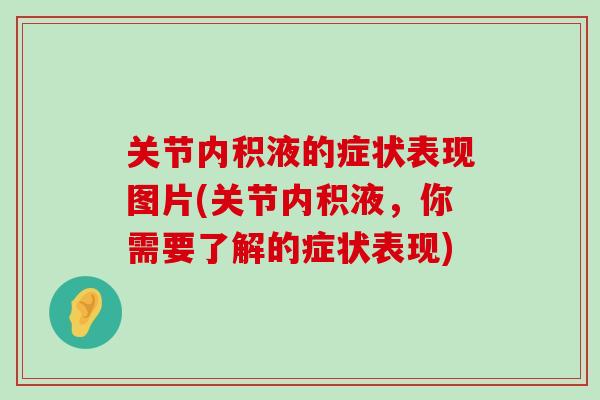 关节内积液的症状表现图片(关节内积液，你需要了解的症状表现)-第1张图片-氨糖科普网