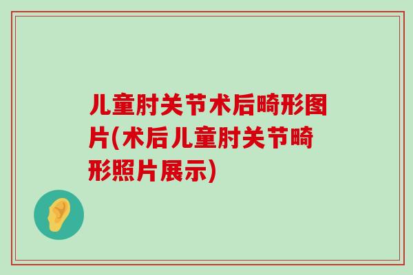 儿童肘关节术后畸形图片(术后儿童肘关节畸形照片展示)-第1张图片-氨糖科普网
