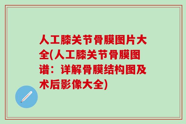 人工膝关节骨膜图片大全(人工膝关节骨膜图谱:详解骨膜结构图及术后影像大全)-第1张图片-氨糖科普网 人工膝关节骨膜图片大全(人工膝关节骨膜图谱:详解骨膜结构图及术后影像大全)-第1张图片-氨糖科普网