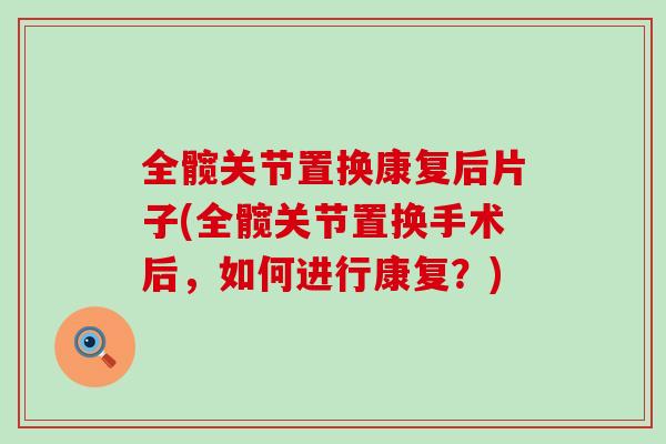 全髋关节置换康复后片子(全髋关节置换手术后,如何进行康复?)-第1张图片-氨糖科普网 全髋关节置换康复后片子(全髋关节置换手术后,如何进行康复?)-第1张图片-氨糖科普网