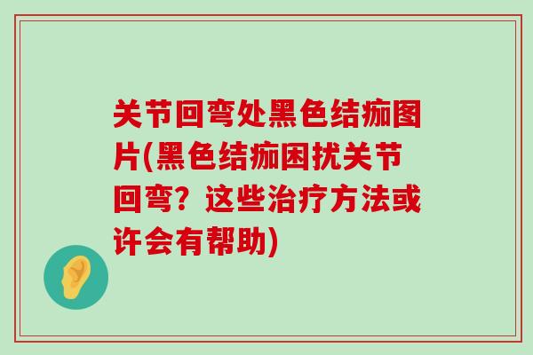 关节回弯处黑色结痂图片(黑色结痂困扰关节回弯?这些治疗方法或许会有帮助)-第1张图片-氨糖科普网 关节回弯处黑色结痂图片(黑色结痂困扰关节回弯?这些治疗方法或许会有帮助)-第1张图片-氨糖科普网