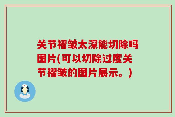 关节褶皱太深能切除吗图片(可以切除过度关节褶皱的图片展示。)-第1张图片-氨糖科普网
