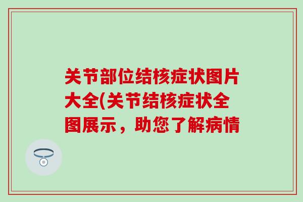 关节部位结核症状图片大全(关节结核症状全图展示,助您了解病情-第1张图片-氨糖科普网 关节部位结核症状图片大全(关节结核症状全图展示,助您了解病情-第1张图片-氨糖科普网
