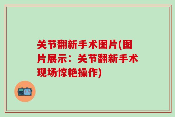 关节翻新手术图片(图片展示:关节翻新手术现场惊艳操作)-第1张图片-氨糖科普网 关节翻新手术图片(图片展示:关节翻新手术现场惊艳操作)-第1张图片-氨糖科普网