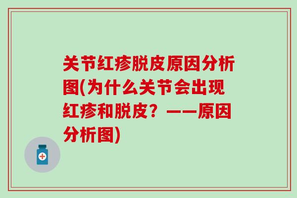 关节红疹脱皮原因分析图(为什么关节会出现红疹和脱皮?——原因分析图)-第1张图片-氨糖科普网 关节红疹脱皮原因分析图(为什么关节会出现红疹和脱皮?——原因分析图)-第1张图片-氨糖科普网