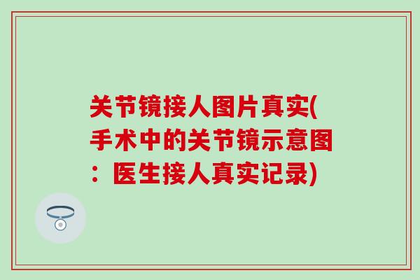 关节镜接人图片真实(手术中的关节镜示意图:医生接人真实记录)-第1张图片-氨糖科普网 关节镜接人图片真实(手术中的关节镜示意图:医生接人真实记录)-第1张图片-氨糖科普网