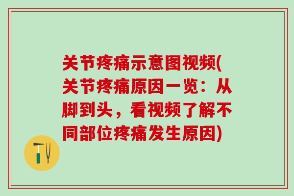 关节疼痛示意图视频(关节疼痛原因一览:从脚到头,看视频了解不同部位疼痛发生原因)-第1张图片-氨糖科普网 关节疼痛示意图视频(关节疼痛原因一览:从脚到头,看视频了解不同部位疼痛发生原因)-第1张图片-氨糖科普网