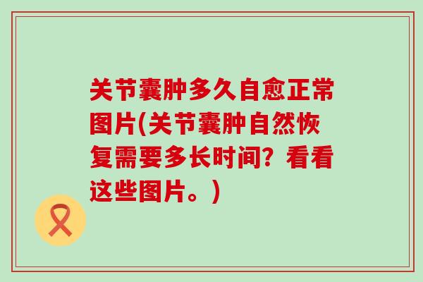 关节囊肿多久自愈正常图片(关节囊肿自然恢复需要多长时间?看看这些图片。)-第1张图片-氨糖科普网 关节囊肿多久自愈正常图片(关节囊肿自然恢复需要多长时间?看看这些图片。)-第1张图片-氨糖科普网